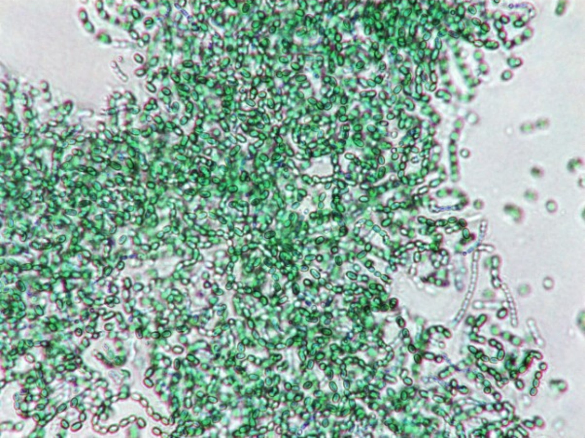 More probiotic strains the better? The surprising truth