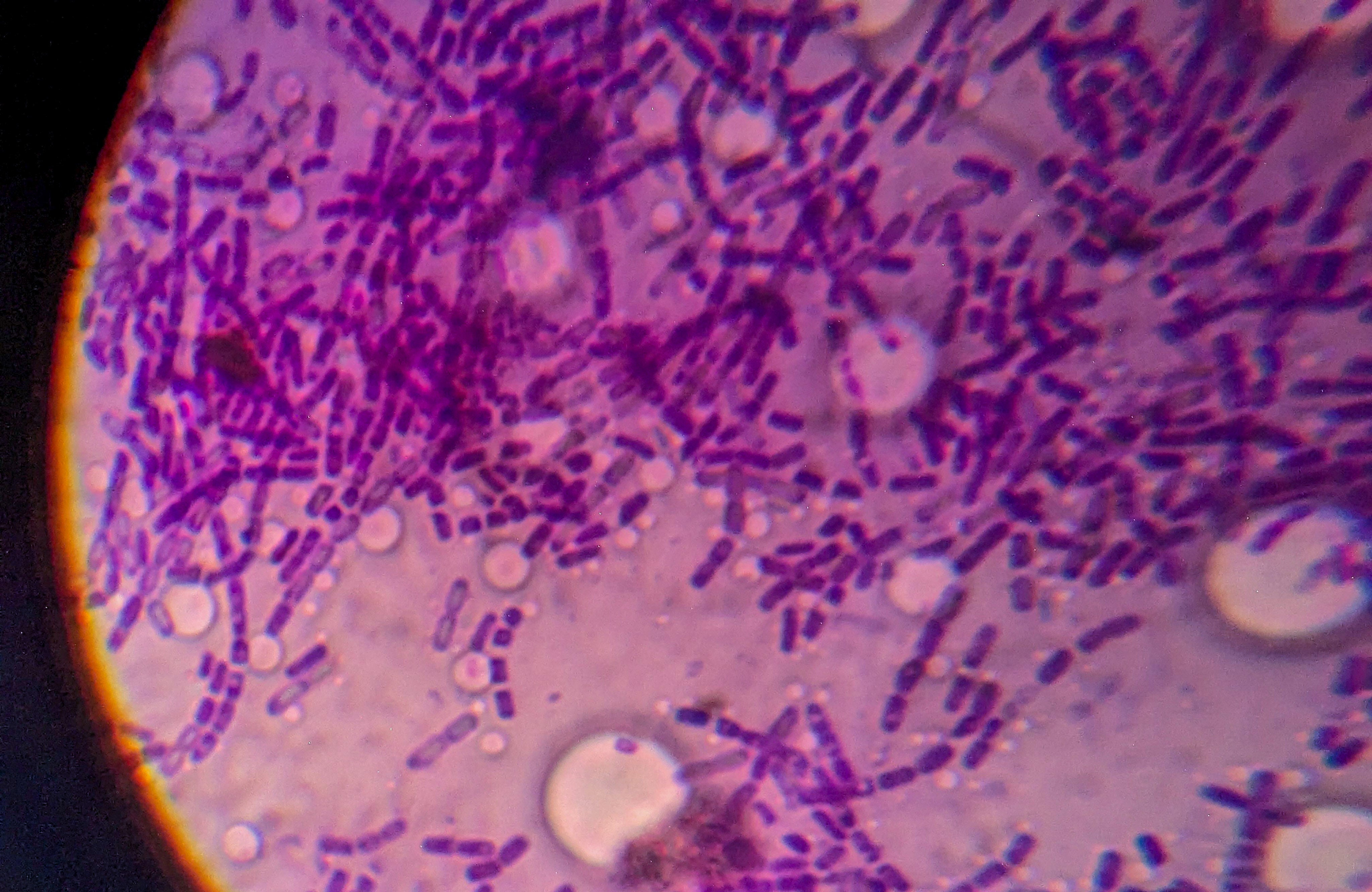 Probiotics for Constipation: BB-12 and HN019 Explained